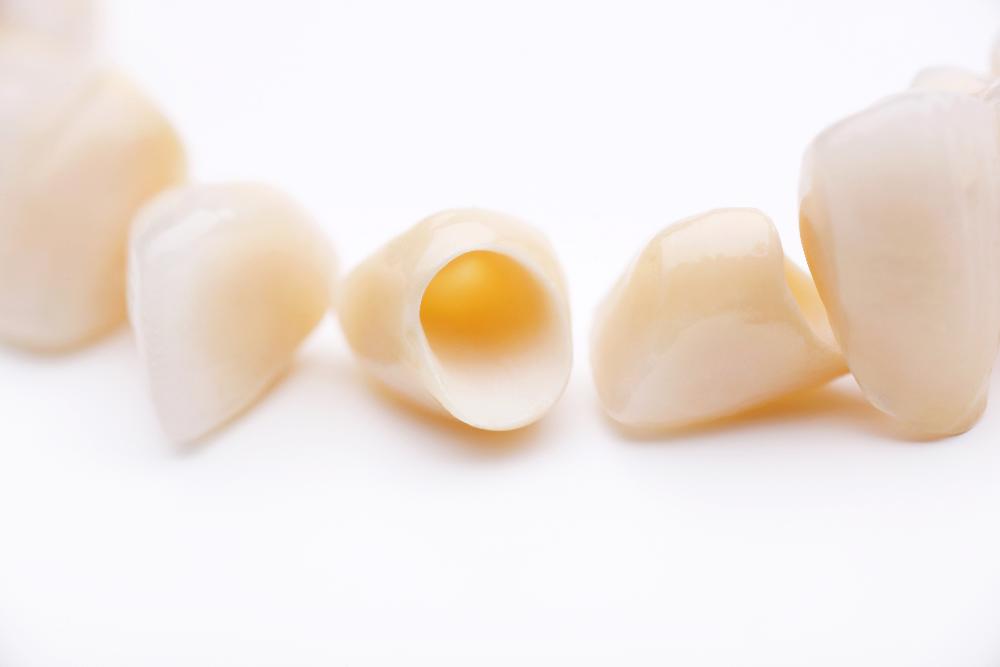 Dental Crowns | Narre Warren Dentist