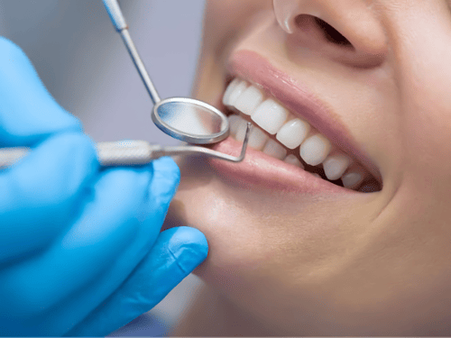 New Patient Professional Check up and Clean